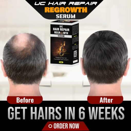 UC Hair Repair Regrowth Serum | Sale Galleria pk